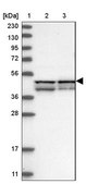 Anti-RMDN2 antibody produced in rabbit Prestige Antibodies&#174; Powered by Atlas Antibodies, affinity isolated antibody, buffered aqueous glycerol solution