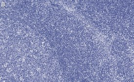 Anti-Caspase-3 Antibody, clone 3J16 , ZooMAb® Rabbit Monoclonal recombinant, expressed in HEK 293 cells