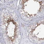Anti-RAB11FIP5 antibody produced in rabbit Prestige Antibodies&#174; Powered by Atlas Antibodies, affinity isolated antibody, buffered aqueous glycerol solution