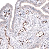 Anti-PLVAP antibody produced in rabbit Prestige Antibodies&#174; Powered by Atlas Antibodies, affinity isolated antibody, buffered aqueous glycerol solution