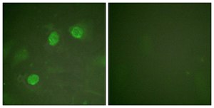 Anti-GATA3 antibody produced in rabbit affinity isolated antibody