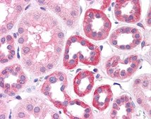 Anti-HNF1A antibody produced in rabbit affinity isolated antibody