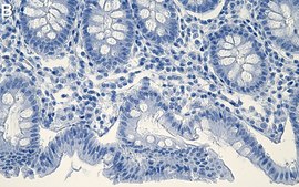 Anti-PBR/TSPO Antibody, clone 1E8 ZooMAb&#174; Rabbit Monoclonal recombinant, expressed in HEK 293 cells