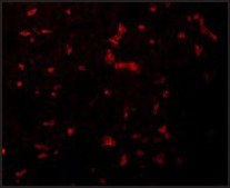 Anti-RIPK1 antibody produced in rabbit affinity isolated antibody, buffered aqueous solution