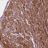 Anti-GOT1 antibody produced in rabbit Prestige Antibodies&#174; Powered by Atlas Antibodies, affinity isolated antibody