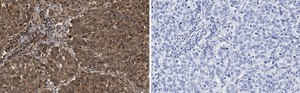 Anti-Skp2 Antibody, clone 1B13 ZooMAb&#174; Rabbit Monoclonal recombinant, expressed in HEK 293 cells