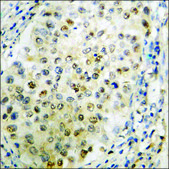 Anti-phospho-MDM4 (pSer367) antibody produced in rabbit affinity isolated antibody