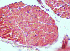 Anti-Guanylyl Cyclase &#945;1 antibody produced in rabbit IgG fraction of antiserum, buffered aqueous solution