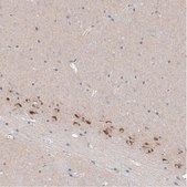 Monoclonal Anti-CTGF antibody produced in mouse Prestige Antibodies&#174; Powered by Atlas Antibodies, clone CL5339, purified immunoglobulin, buffered aqueous glycerol solution