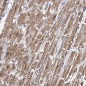 Anti-CAMK2D antibody produced in rabbit Prestige Antibodies® Powered by Atlas Antibodies, affinity isolated antibody, buffered aqueous glycerol solution