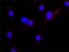 Anti-Twist1 antibody produced in rabbit ~1&#160;mg/mL, affinity isolated antibody, buffered aqueous solution