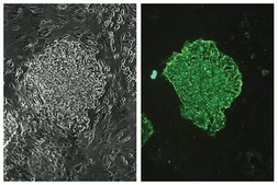 Anti-Stage-Specific Embryonic Antigen-4 Antibody, clone MC-813-70 clone MC-813-70, Chemicon&#174;, from mouse