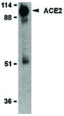 Anti-ACE2 antibody produced in rabbit affinity isolated antibody
