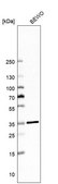 Anti-MARC1 antibody produced in rabbit Prestige Antibodies&#174; Powered by Atlas Antibodies, affinity isolated antibody, buffered aqueous glycerol solution