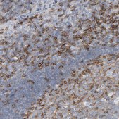 Anti-FYN antibody produced in rabbit Prestige Antibodies&#174; Powered by Atlas Antibodies, affinity isolated antibody, buffered aqueous glycerol solution