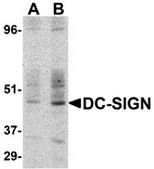 Anti-DC-SIGN antibody produced in rabbit affinity isolated antibody