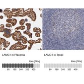 Anti-LAMC1 antibody produced in rabbit Ab1, Prestige Antibodies&#174; Powered by Atlas Antibodies, affinity isolated antibody, buffered aqueous glycerol solution