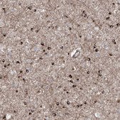 Anti-APAF1 antibody produced in rabbit Prestige Antibodies&#174; Powered by Atlas Antibodies, affinity isolated antibody, buffered aqueous glycerol solution