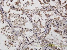 Monoclonal Anti-ACTN4 antibody produced in mouse clone 4D10, purified immunoglobulin, buffered aqueous solution