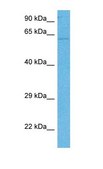 Anti-PPP2R1A, (N-terminal) antibody produced in rabbit affinity isolated antibody