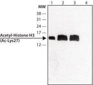 Anti-acetyl-Histone H3 (Ac-Lys27) antibody produced in rabbit ~1.0&#160;mg/mL, affinity isolated antibody