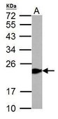 Anti-GPX1 antibody produced in rabbit affinity isolated antibody, buffered aqueous solution