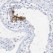 Anti-SPATA3 antibody produced in rabbit Prestige Antibodies&#174; Powered by Atlas Antibodies, affinity isolated antibody, buffered aqueous glycerol solution