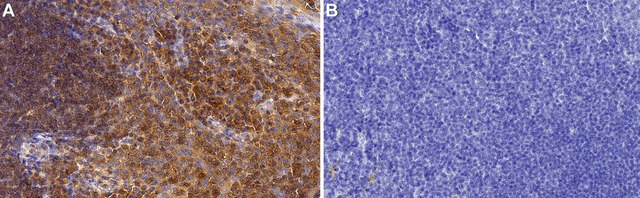 Anti-RhoA Antibody, clone 1K8 ZooMAb&#174; Rabbit Monoclonal recombinant, expressed in HEK 293 cells