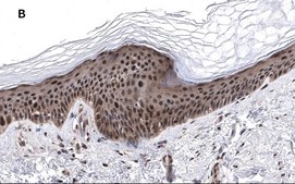 Anti-phos-AMPK&#945; (Thr172) Antibody, clone 5J23 , ZooMAb&#174; Rabbit Monoclonal recombinant, expressed in HEK 293 cells