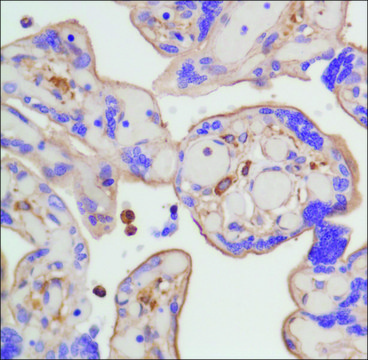 Anti-beta-Actin antibody, Rabbit monoclonal recombinant, expressed in proprietary host, clone SP124, affinity isolated antibody