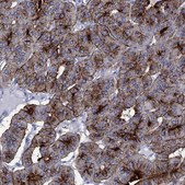 Anti-DPP4 antibody produced in rabbit Prestige Antibodies® Powered by Atlas Antibodies, affinity isolated antibody, buffered aqueous glycerol solution