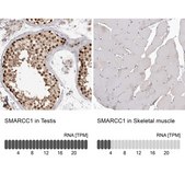 Anti-SMARCC1 antibody produced in rabbit Prestige Antibodies&#174; Powered by Atlas Antibodies, affinity isolated antibody, buffered aqueous glycerol solution