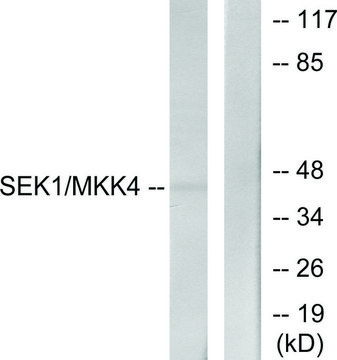 Anti-SEK1 antibody produced in rabbit affinity isolated antibody