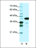 Anti-TARDBP (AB1) antibody produced in rabbit IgG fraction of antiserum