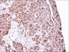 Anti-LRPPRC antibody produced in rabbit affinity isolated antibody, buffered aqueous solution