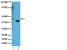 Anti-Cytochrome P450 Enzyme CYP2E1 Antibody serum, Chemicon&#174;
