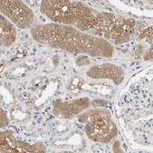 Anti-IL1RL1 antibody produced in rabbit Ab2, Prestige Antibodies&#174; Powered by Atlas Antibodies, affinity isolated antibody, buffered aqueous glycerol solution