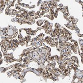 Anti-MYO1C antibody produced in rabbit Prestige Antibodies&#174; Powered by Atlas Antibodies, affinity isolated antibody, buffered aqueous glycerol solution