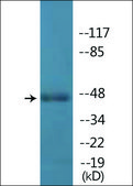 Anti-phospho-IRF-3 (pSer396) antibody produced in rabbit affinity isolated antibody