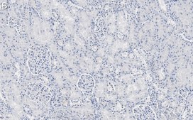 Anti-Nestin Antibody, clone 10C2 ZooMAb&#174; Mouse Monoclonal recombinant, expressed in HEK 293 cells