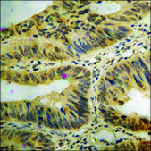Anti-phospho-ATF2 (pThr73 or 55) antibody produced in rabbit affinity isolated antibody