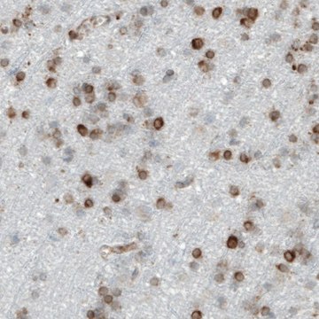 Monoclonal Anti-MTDH antibody produced in mouse Prestige Antibodies® Powered by Atlas Antibodies, clone CL0401, purified immunoglobulin, buffered aqueous glycerol solution