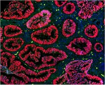 Anti-p53 (pantropic) Antibody, clone DO-1 clone DO-1, from mouse