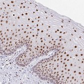 Anti-FOSL2 antibody produced in rabbit Prestige Antibodies&#174; Powered by Atlas Antibodies, affinity isolated antibody, buffered aqueous glycerol solution