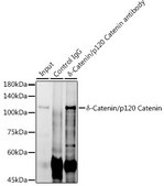 Anti-&#948;-Catenin/p120 Catenin Antibody, clone 5N7Z0, Rabbit Monoclonal