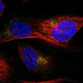 Anti-IGF2R antibody produced in rabbit Prestige Antibodies&#174; Powered by Atlas Antibodies, affinity isolated antibody, buffered aqueous glycerol solution