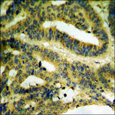 Anti-phospho-p53 (pThr387) antibody produced in rabbit affinity isolated antibody