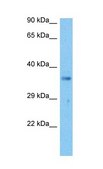 Anti-NPM1 (AB2) antibody produced in rabbit IgG fraction of antiserum