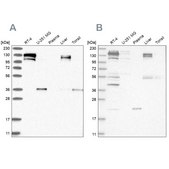 Anti-CGN antibody produced in rabbit Prestige Antibodies&#174; Powered by Atlas Antibodies, affinity isolated antibody, buffered aqueous glycerol solution, ab3