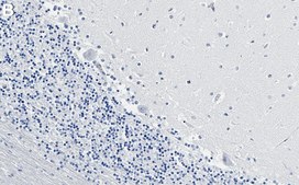 Anti-Myosin-10 Antibody, clone 1B3 ZooMAb&#174; Rabbit Monoclonal recombinant, expressed in HEK 293 cells